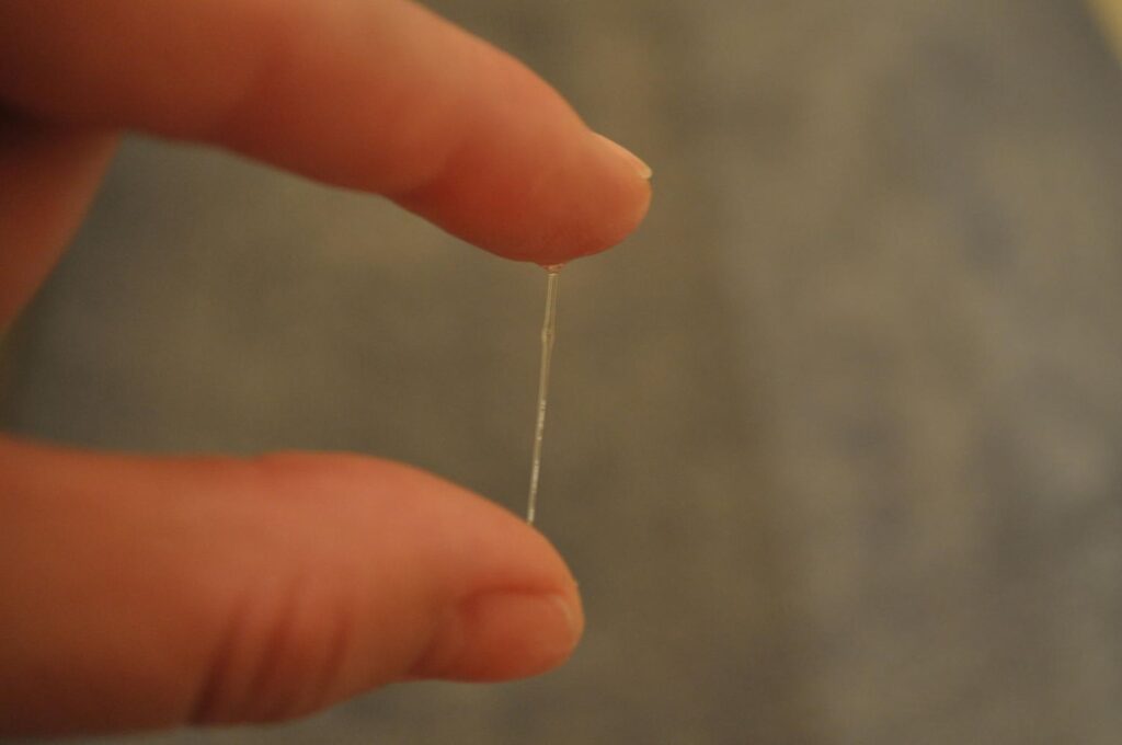 vaginal discharge